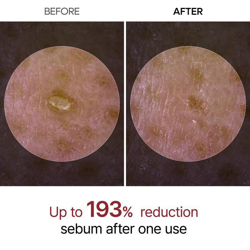 ๐ Peel Shot Glow Rice Ampoule Duo