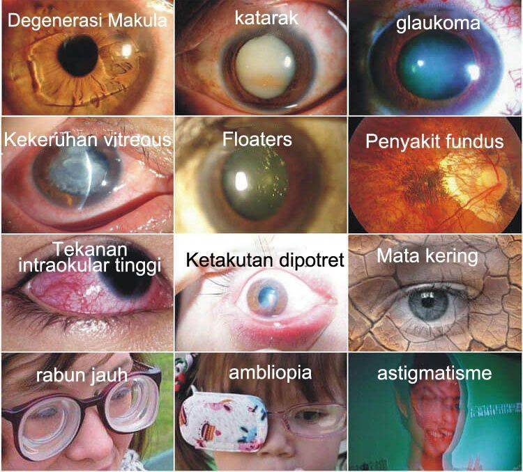 Clinclii Japan Vision Drops — Rapidly Heals All Eye Conditions & Restores Vision